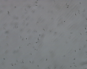 Fertility GIF
